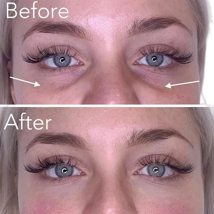 Auré 3-Piece Bundle